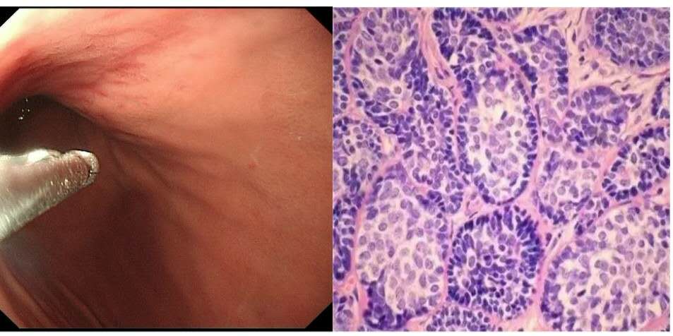 胃不舒服怎么办隐隐作痛,胃不舒服怎么办按哪个穴位