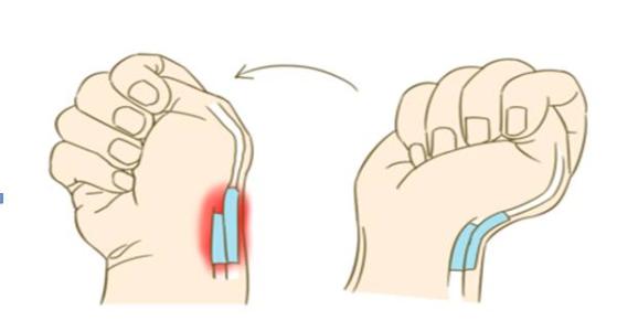 腱鞘炎大拇指怎么引起的,右手大拇指腱鞘炎最好的治疗方法