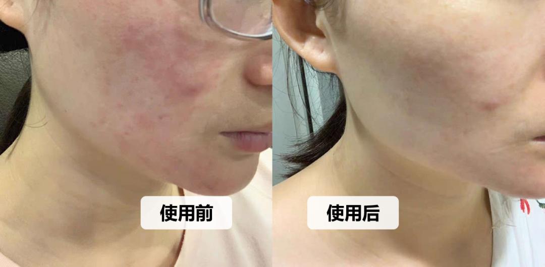 如果买到假货如何打假,打假扫盲市面上的假货