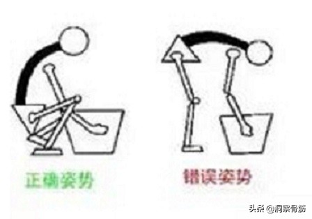 腰痛引起脊柱侧弯,脊柱侧弯不是很严重但是腰疼