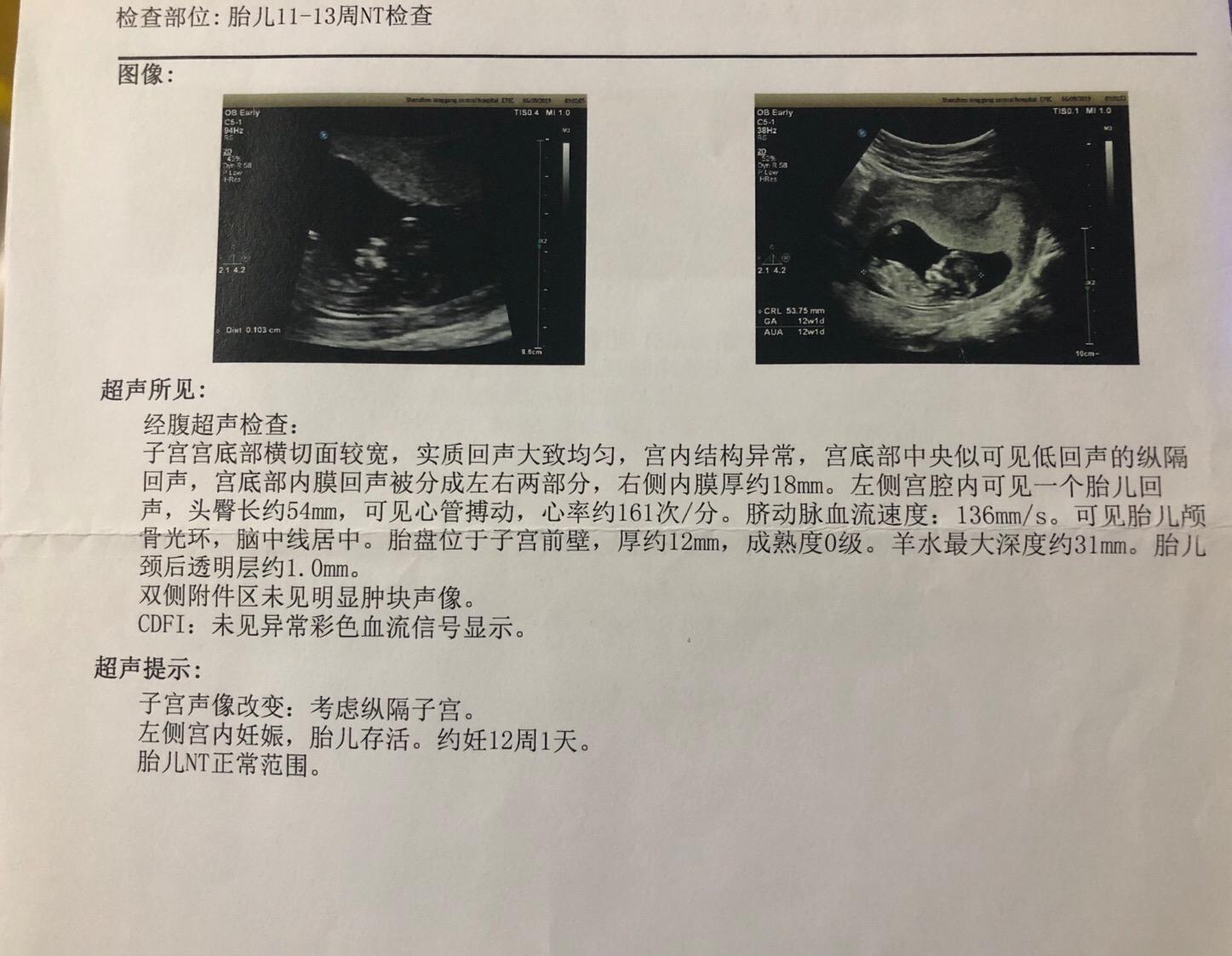 妇产科专家讲解孕酮,产科医生深度解析