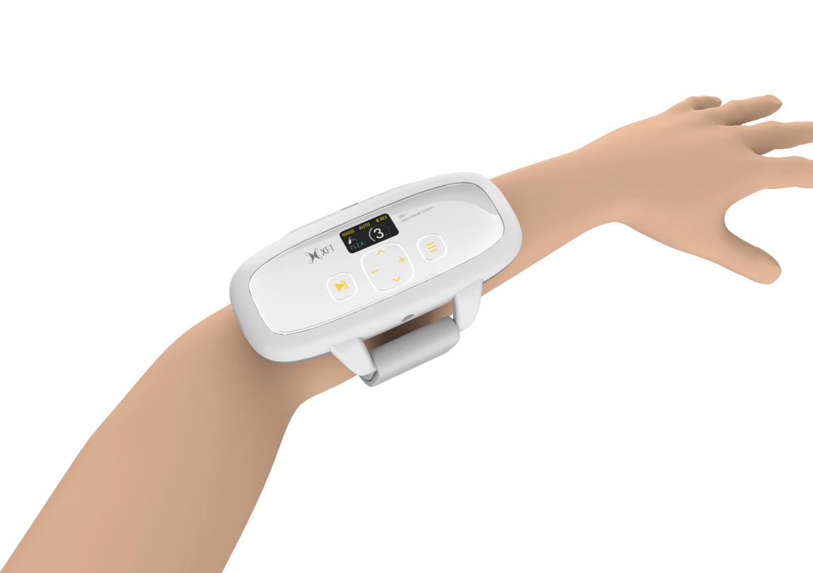 生物反馈电刺激治疗费用,生物反馈电刺激治疗操作流程