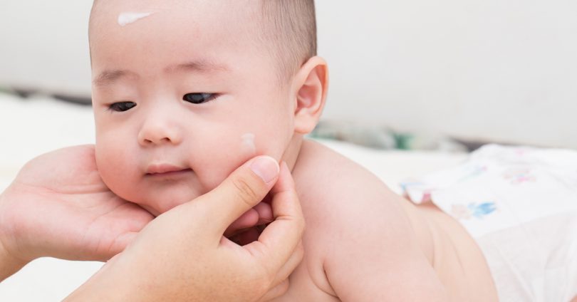 宝宝湿疹可以抹乳液吗,婴儿脸上湿疹可以涂乳液吗