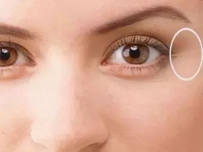 鼻子长痘是肝火还是胃火,鼻子长斑是代表什么部位有癌症