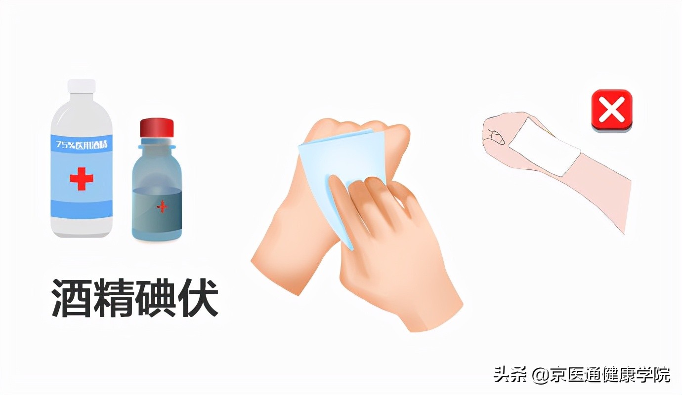 被猫狗抓伤咬伤怎么办,被猫狗抓伤第一步应该怎么处理