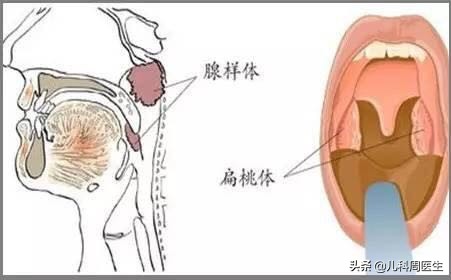 小孩睡觉张嘴打呼噜的真实视频,孩子睡觉打呼噜丑态