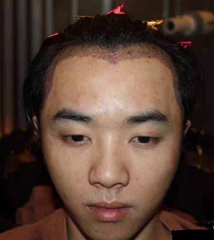 华晨宇与张碧晨最早绯闻,华晨宇和张碧晨绯闻