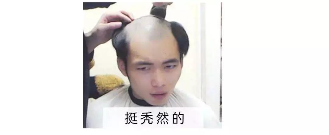 每天掉100根头发会变秃头吗,头上有多少根头发算秃头