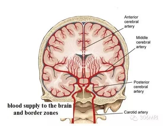 大脑深部白质区见斑点状异常信号,脑白质病变建议mri检查是什么意思