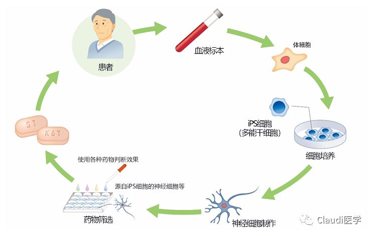 已成功两例！研究发现：移植正常眼部干细胞可治疗失明