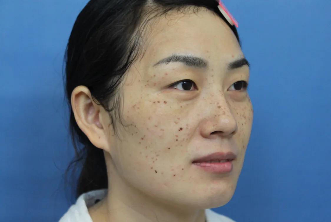 用逍遥丸来疏肝再祛湿效果惊人,肝火旺肝血虚逍遥丸管用吗