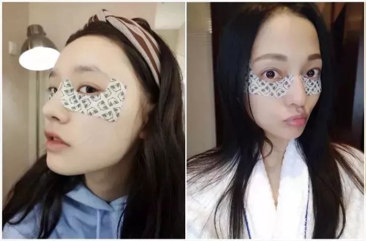 林允张韶涵面膜,林允同款眼膜推荐