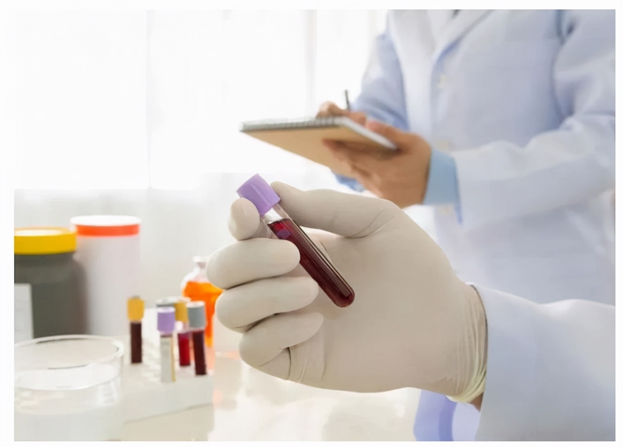 血常规检查三项偏高,血常规检查3项高有什么病