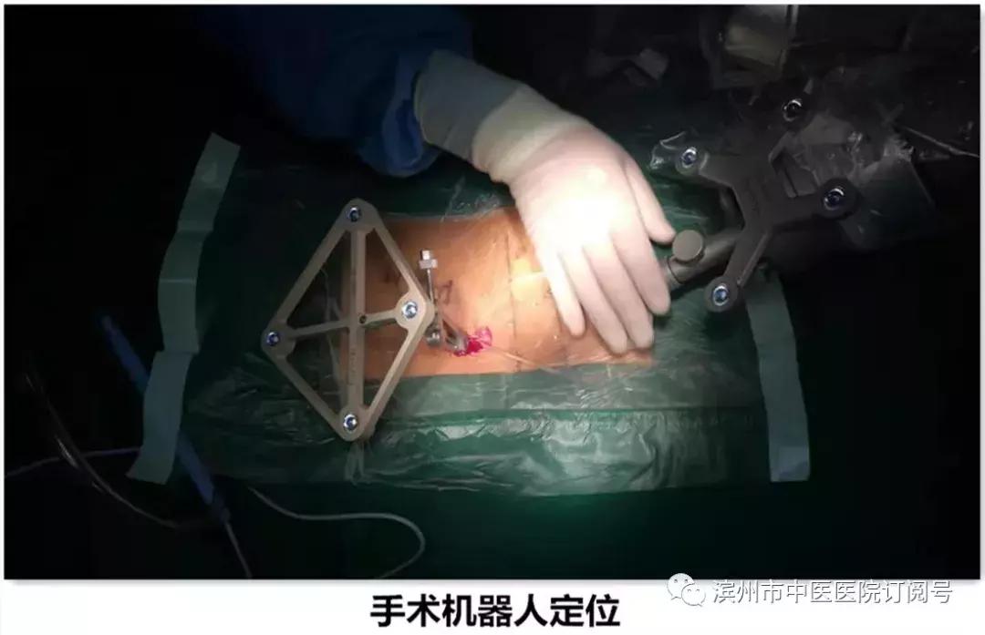 椎间盘突出保守治疗,椎间盘治疗视频大全