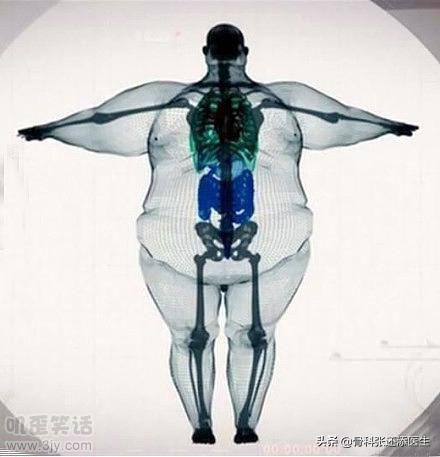 颈椎检查拍x光挂什么科,x光ct核磁b超区别视频