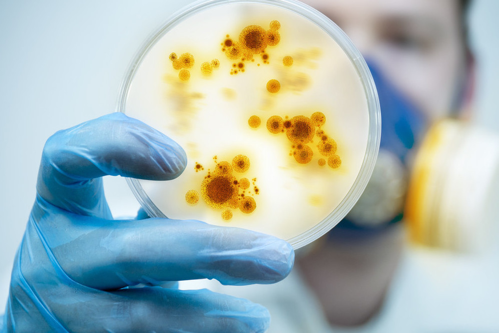 下体特别臭异味重是怎么了,下体总是有难闻的臭味怎么解决