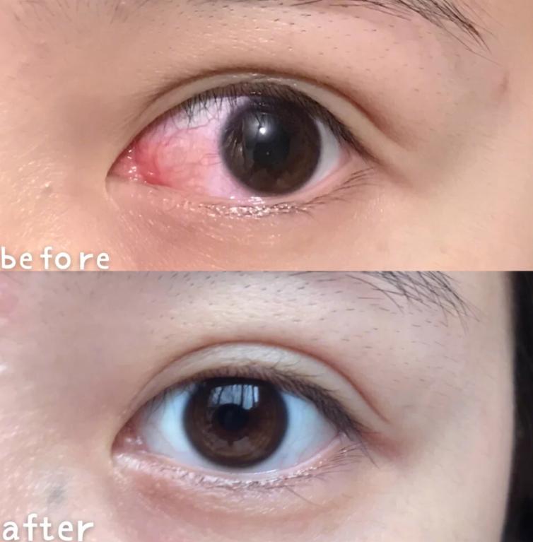 脸上的小瑕疵用什么护肤品比较好,脸部护肤的十大误区