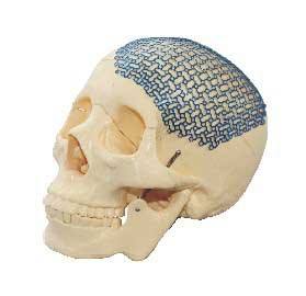 脑膜瘤有些什么症状,脑膜瘤症状有哪些啊