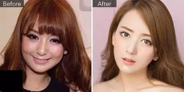 武汉一整形机构*脑洗**女大学生签高息*款贷**，称颜值即未来，外貌焦虑