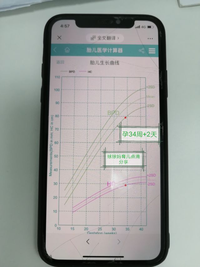 宝宝b超显示小了5天,宝宝b超偏小3周预产期会推后吗