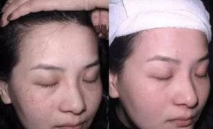 女人脸上有斑点是怎么回事,50岁女人脸上有斑点怎么消除