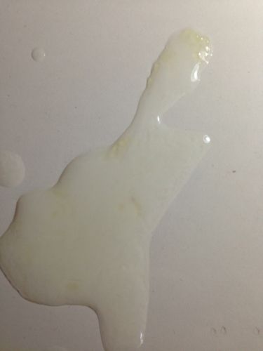 精子质量检测深度学习,精子质量检测怎么做