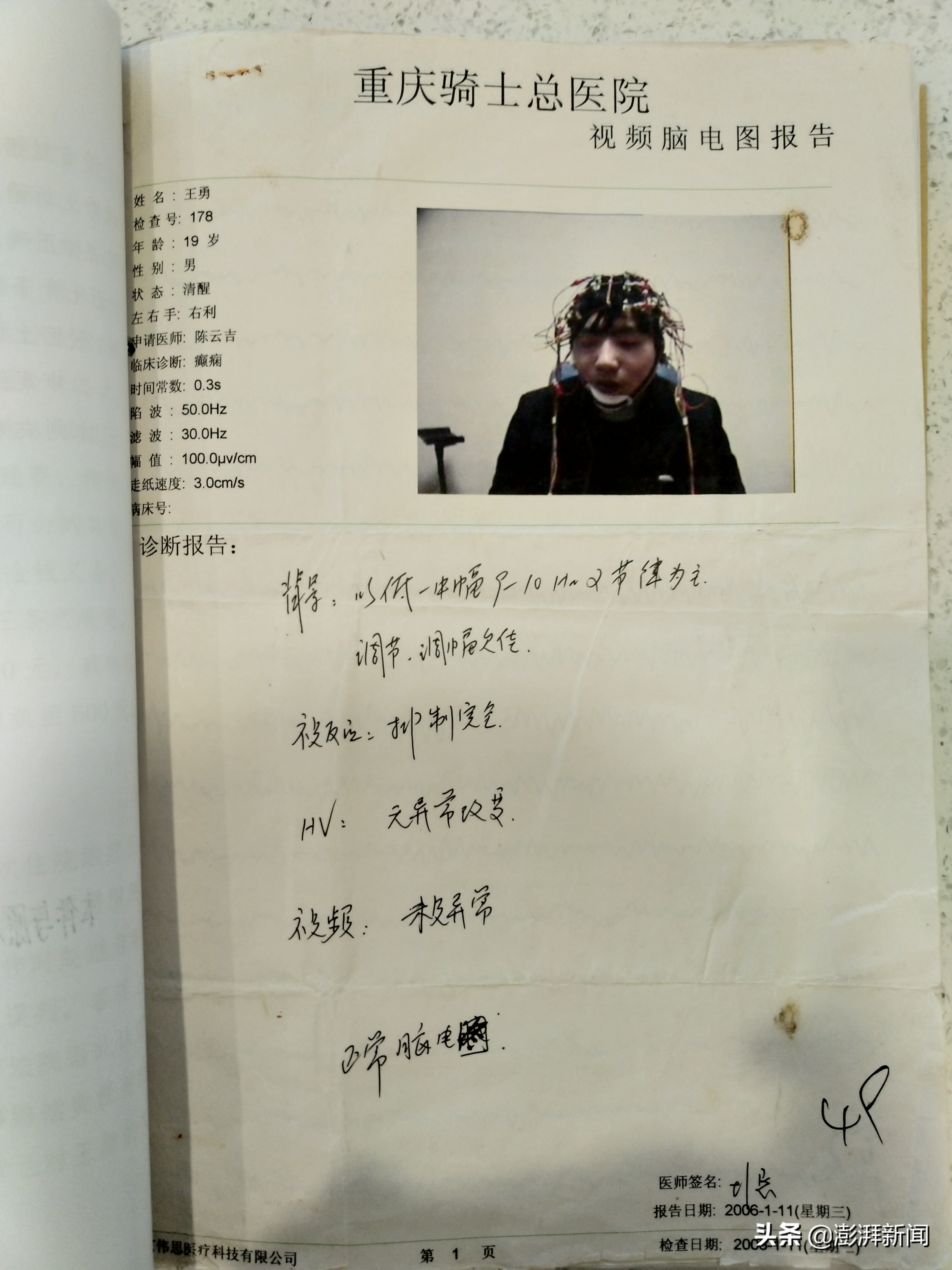 癫痫病人死亡,癫痫病人一夜死亡