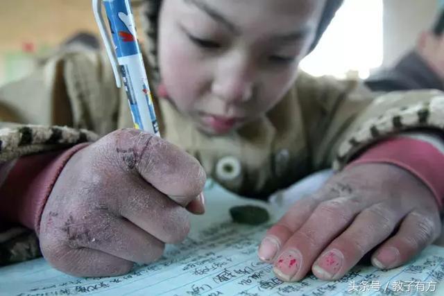 轻度冻伤怎么处理最佳方法,严重冻伤及时处理方法