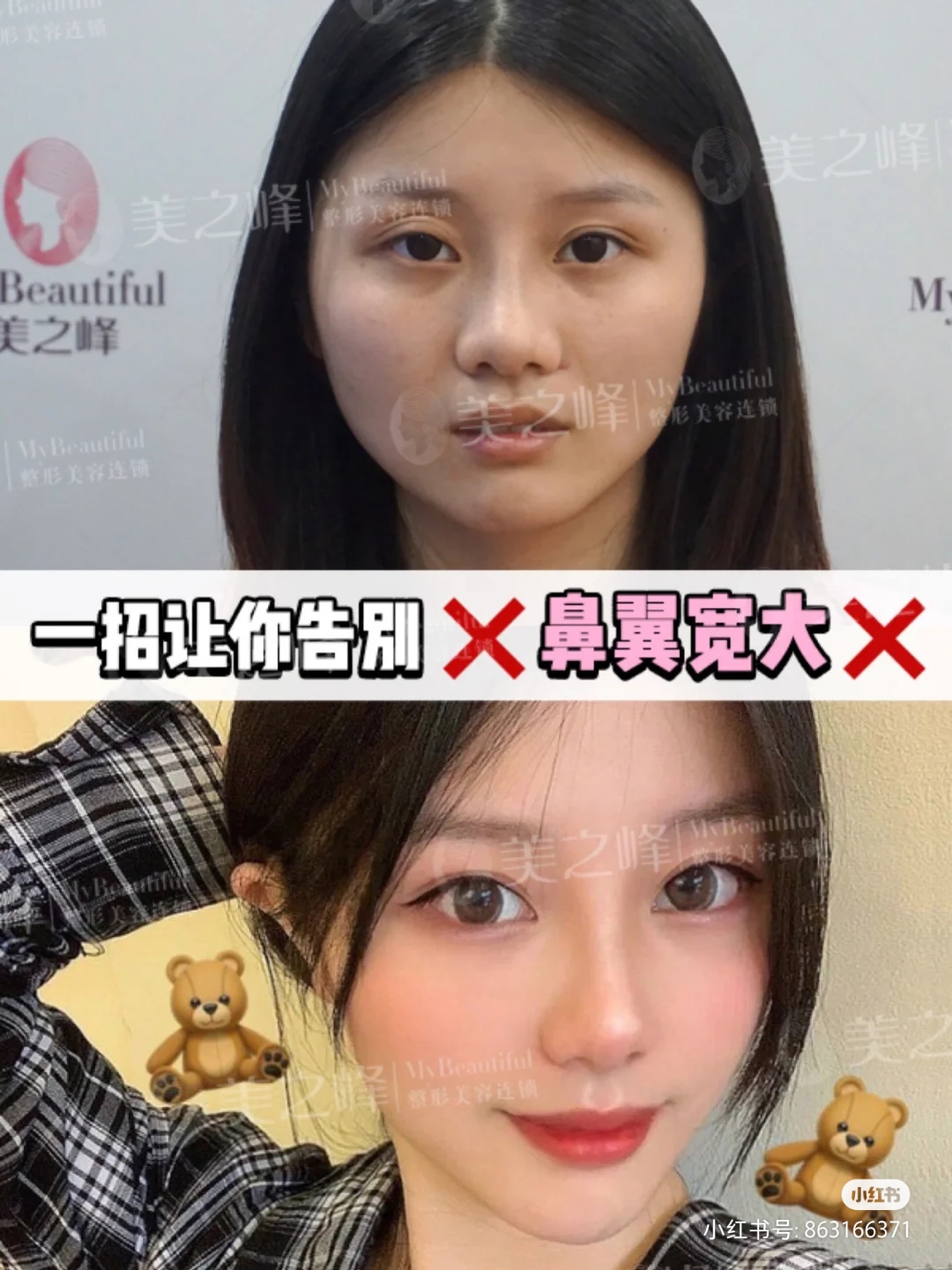 美之峰长沙,长沙美之峰最新视频