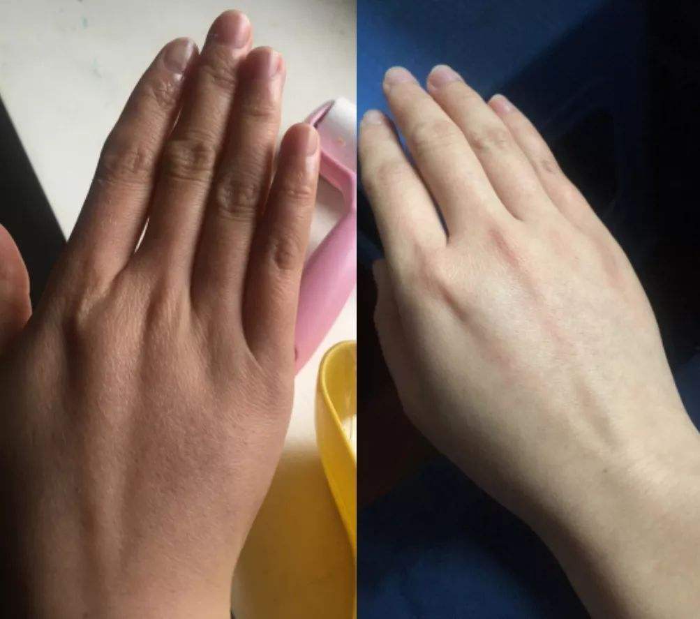 王凯手被投保3600万?林更新堵车时不忘涂手霜,我承认自己不精致