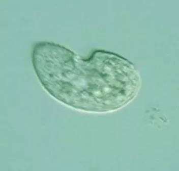 污泥镜检操作方法,污泥检测项目及标准有哪些呢