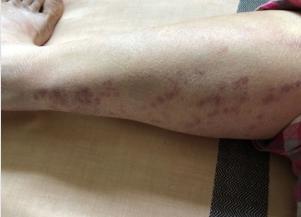 拍打膀胱有什么好处,拍打膀胱有助排尿吗