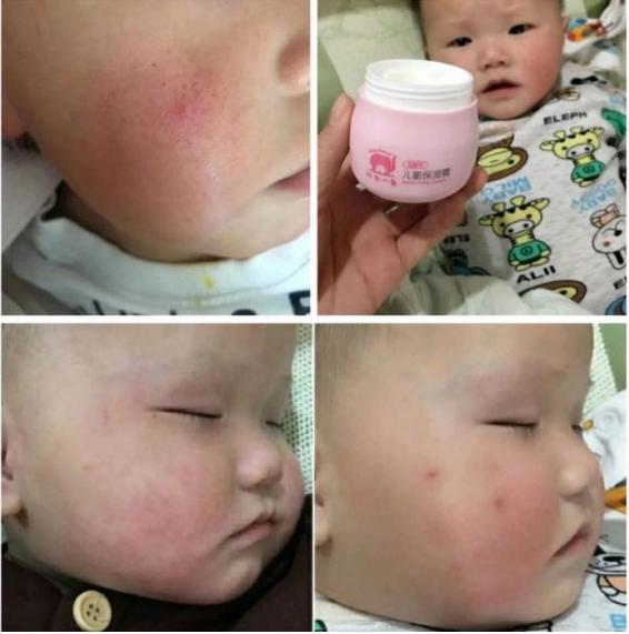 林志颖面霜推荐,儿童面霜测评林志颖代言