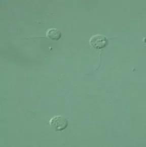 污泥镜检操作方法,污泥检测项目及标准有哪些呢