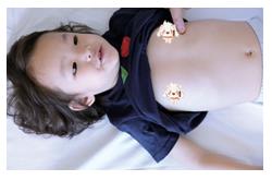 小儿打嗝停不下来,教你推拿手法和食疗秘方巧止呃