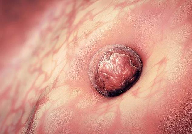 孕7周到11周感觉孕吐又严重了,刚测出怀孕就有孕吐反应正常吗