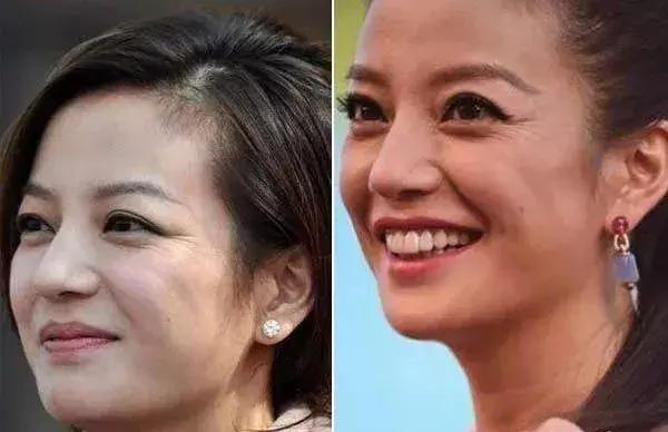 护肤反而皮肤差,改掉这些护肤恶习让你越变越美丽