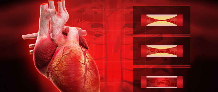 “颈动脉”被堵塞导致偏瘫，做“支架”还有意义吗？