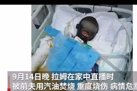 网红拉姆遭前夫纵火焚烧,网红拉姆遭前夫纵火现场