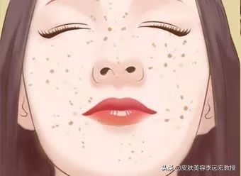 做一个脸上无斑的女人,女人脸上没有斑了