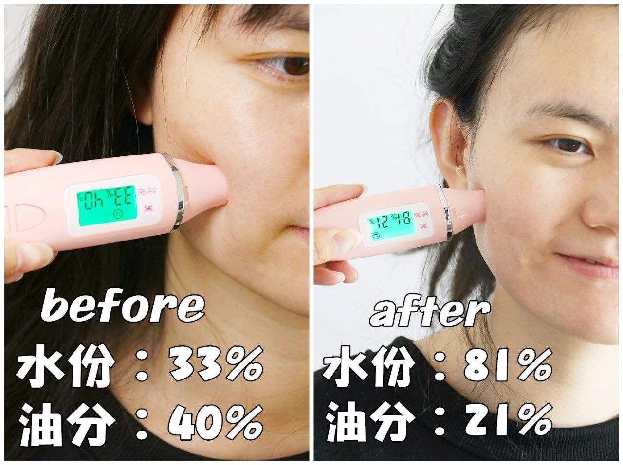 起皮是因为要去角质吗,起皮需要去角质