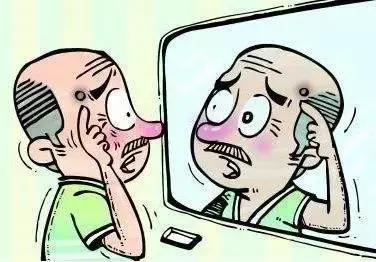 黑痣要去掉吗？专家和你聊聊关于“黑痣”的那些事儿