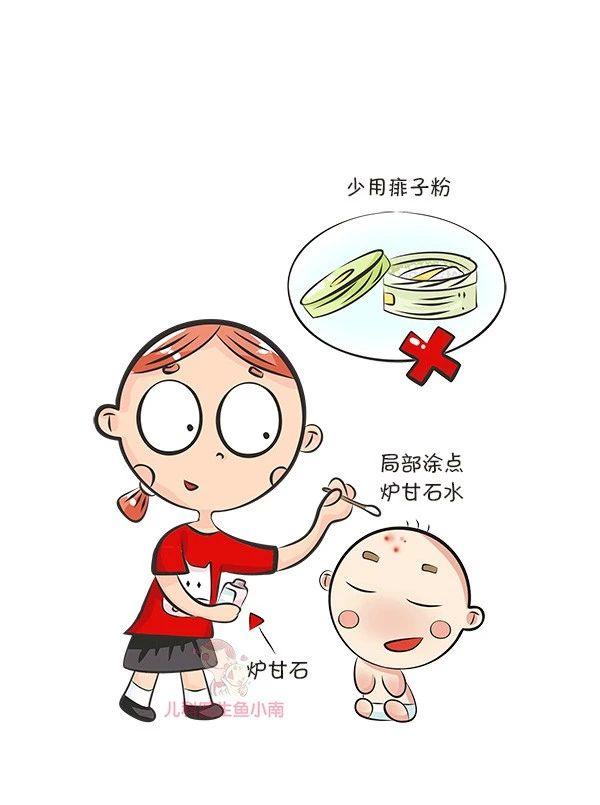 热疹皮疹湿疹有什么区别,湿疹和荨麻疹有什么区别怎样判断