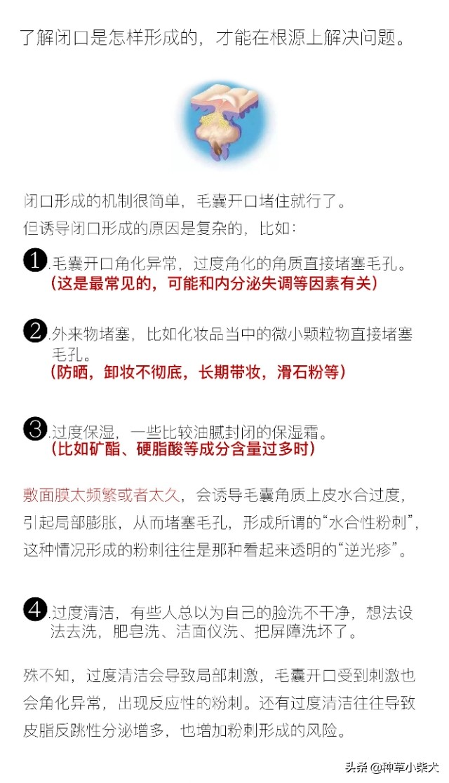 “土”血总结｜保姆级去闭口教程合集