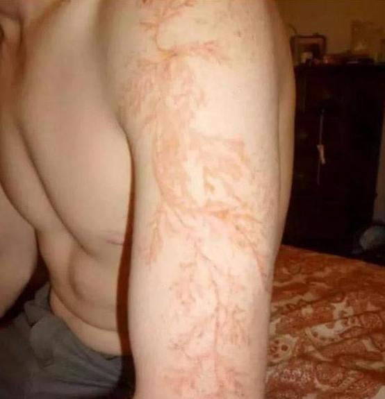 圣女为何无故流泪？神秘女子为何频频放电？闪电也能给人纹身？