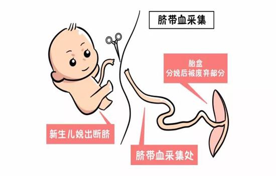 储存脐带血能治白血病？