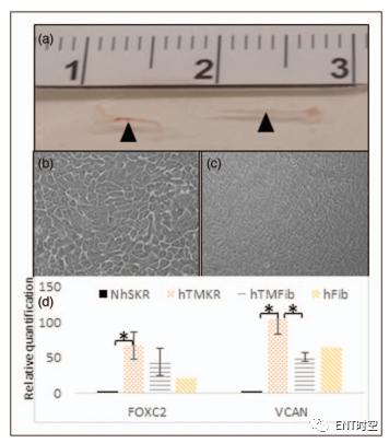 鼓膜再生,耳膜再生复原技术