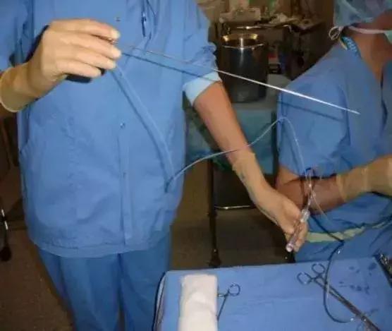 老公和婆婆背着儿媳,被“租子宫包生儿子”小广告骗了85万!活该