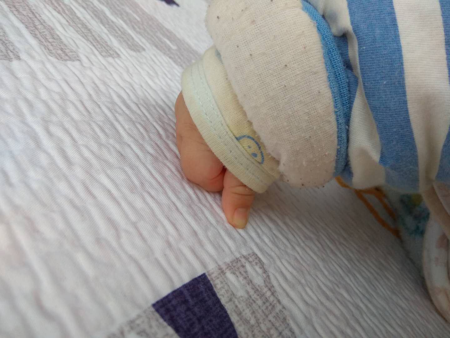 宝宝烂嘴角怎么快速消除,宝宝烂嘴角怎么办最快最有效