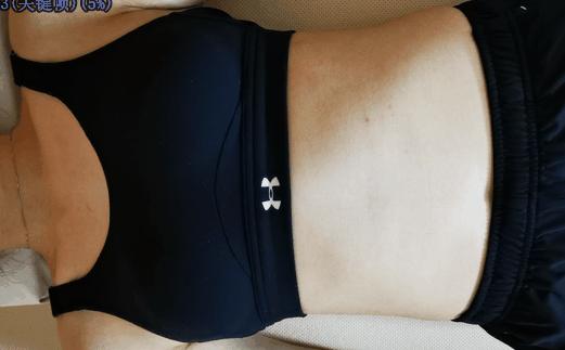 髋关节抬腿咯噔响移位,抬腿放下时髋关节弹响